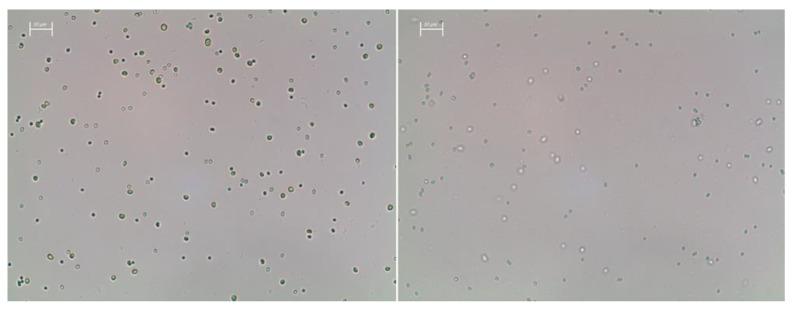 https://cdn.ncbi.nlm.nih.gov/pmc/blobs/5797/9030849/acd3a82f8350/bioengineering-09-00178-g0A1.jpg
