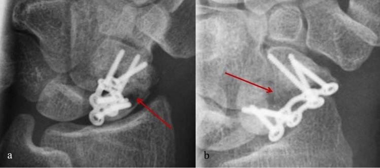 https://cdn.ncbi.nlm.nih.gov/pmc/blobs/5797/9120041/23fa1ab75d7e/41598_2022_12305_Fig3_HTML.jpg