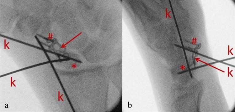 https://cdn.ncbi.nlm.nih.gov/pmc/blobs/5797/9120041/fac762629745/41598_2022_12305_Fig1_HTML.jpg