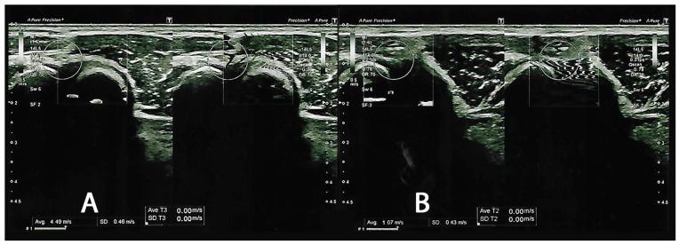 https://cdn.ncbi.nlm.nih.gov/pmc/blobs/579e/11012724/e632f6f90e84/jcm-13-02014-g002.jpg