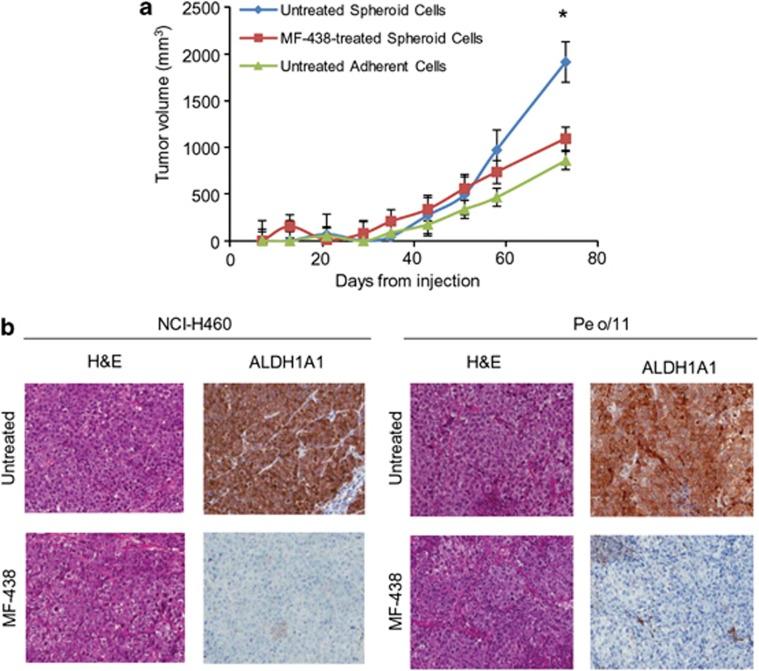 https://cdn.ncbi.nlm.nih.gov/pmc/blobs/57a4/3877537/6184cf92c227/cddis2013444f6.jpg