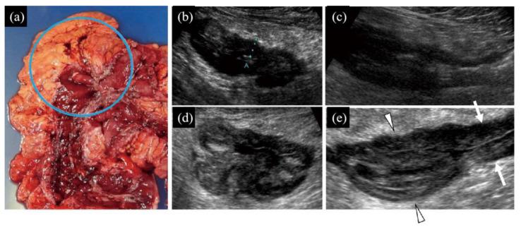 https://cdn.ncbi.nlm.nih.gov/pmc/blobs/57a4/7277370/768b2bfa43b5/diagnostics-10-00267-g004.jpg