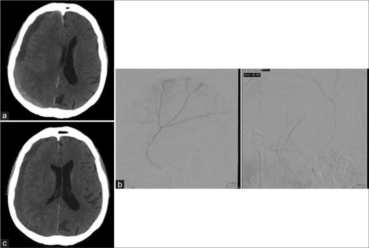 https://cdn.ncbi.nlm.nih.gov/pmc/blobs/57a5/10316227/da43b1d33150/SNI-14-223-g001.jpg