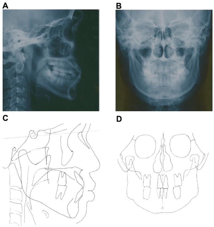 https://cdn.ncbi.nlm.nih.gov/pmc/blobs/57a5/11256973/042b28fa683d/cureus-0016-00000062563-i02.jpg