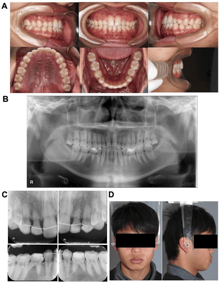 https://cdn.ncbi.nlm.nih.gov/pmc/blobs/57a5/11256973/2c4ee6369473/cureus-0016-00000062563-i07.jpg