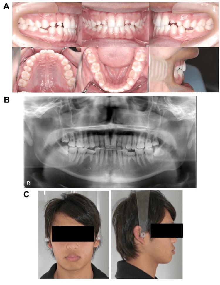 https://cdn.ncbi.nlm.nih.gov/pmc/blobs/57a5/11256973/a97b21f5faf7/cureus-0016-00000062563-i04.jpg