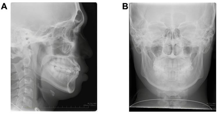 https://cdn.ncbi.nlm.nih.gov/pmc/blobs/57a5/11256973/b1fbc8833fce/cureus-0016-00000062563-i06.jpg