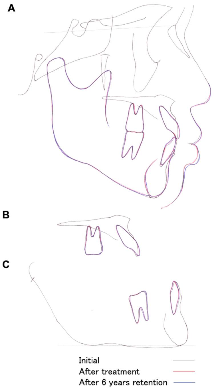 https://cdn.ncbi.nlm.nih.gov/pmc/blobs/57a5/11256973/d69fd5dc0d2e/cureus-0016-00000062563-i10.jpg