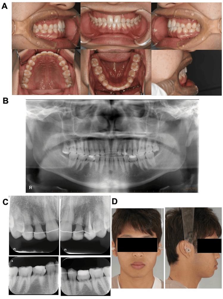 https://cdn.ncbi.nlm.nih.gov/pmc/blobs/57a5/11256973/dcea52fe22ae/cureus-0016-00000062563-i08.jpg