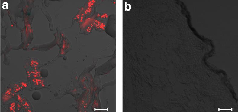 https://cdn.ncbi.nlm.nih.gov/pmc/blobs/57a5/8219184/57931b5d4616/photob.2020.4957_figure2.jpg