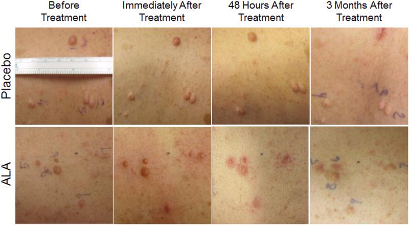 https://cdn.ncbi.nlm.nih.gov/pmc/blobs/57a5/8219184/5fa69253712f/photob.2020.4957_figure3.jpg