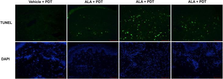 https://cdn.ncbi.nlm.nih.gov/pmc/blobs/57a5/8219184/fb01057d4fb1/photob.2020.4957_figure5.jpg