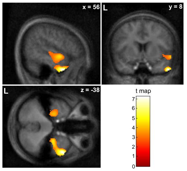 https://cdn.ncbi.nlm.nih.gov/pmc/blobs/57ab/3146896/7b92f8c68587/1471-2202-12-66-3.jpg