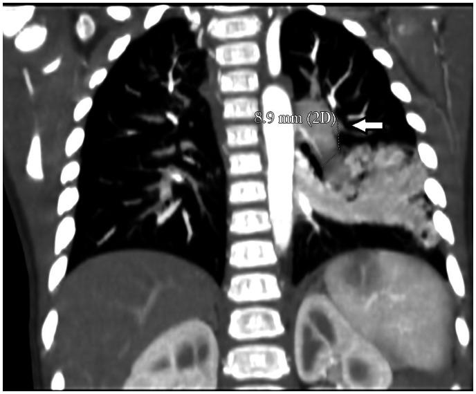 https://cdn.ncbi.nlm.nih.gov/pmc/blobs/57ad/8343466/032b16869778/ytab261f3.jpg