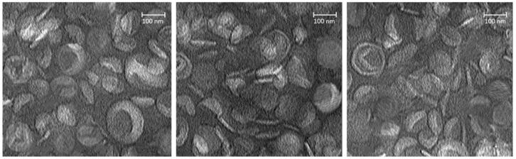 https://cdn.ncbi.nlm.nih.gov/pmc/blobs/57b8/11859135/d0240c64a4f7/pharmaceutics-17-00190-g004.jpg