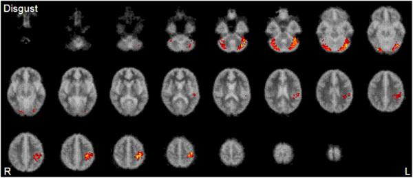 https://cdn.ncbi.nlm.nih.gov/pmc/blobs/57b8/4429366/6c72eb6541c2/11689_2014_109_Fig1_HTML.jpg