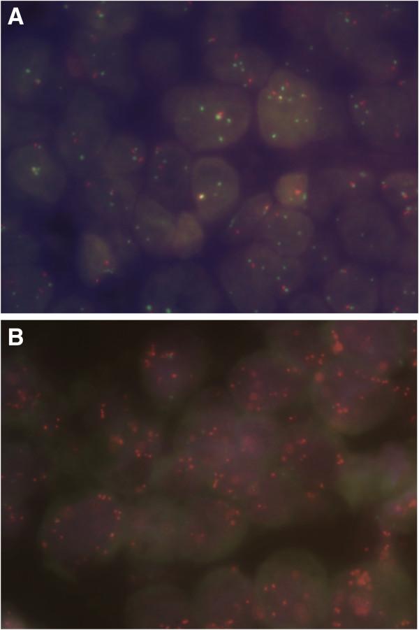 https://cdn.ncbi.nlm.nih.gov/pmc/blobs/57c3/3840598/10c0c91d168f/1471-2407-13-541-3.jpg