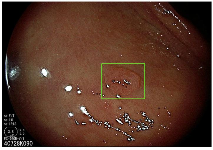 https://cdn.ncbi.nlm.nih.gov/pmc/blobs/57c6/10047293/1a15c420a7cd/diagnostics-13-01102-g002.jpg