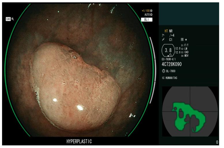 https://cdn.ncbi.nlm.nih.gov/pmc/blobs/57c6/10047293/dcc49b7a0d33/diagnostics-13-01102-g003.jpg