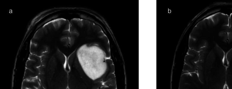 https://cdn.ncbi.nlm.nih.gov/pmc/blobs/57c7/12000273/437a171a4fa1/701_2025_6521_Fig4_HTML.jpg
