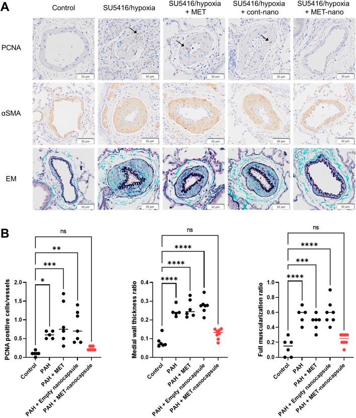 https://cdn.ncbi.nlm.nih.gov/pmc/blobs/57c8/12075939/b1bae373fd0d/fphar-16-1577570-g004.jpg
