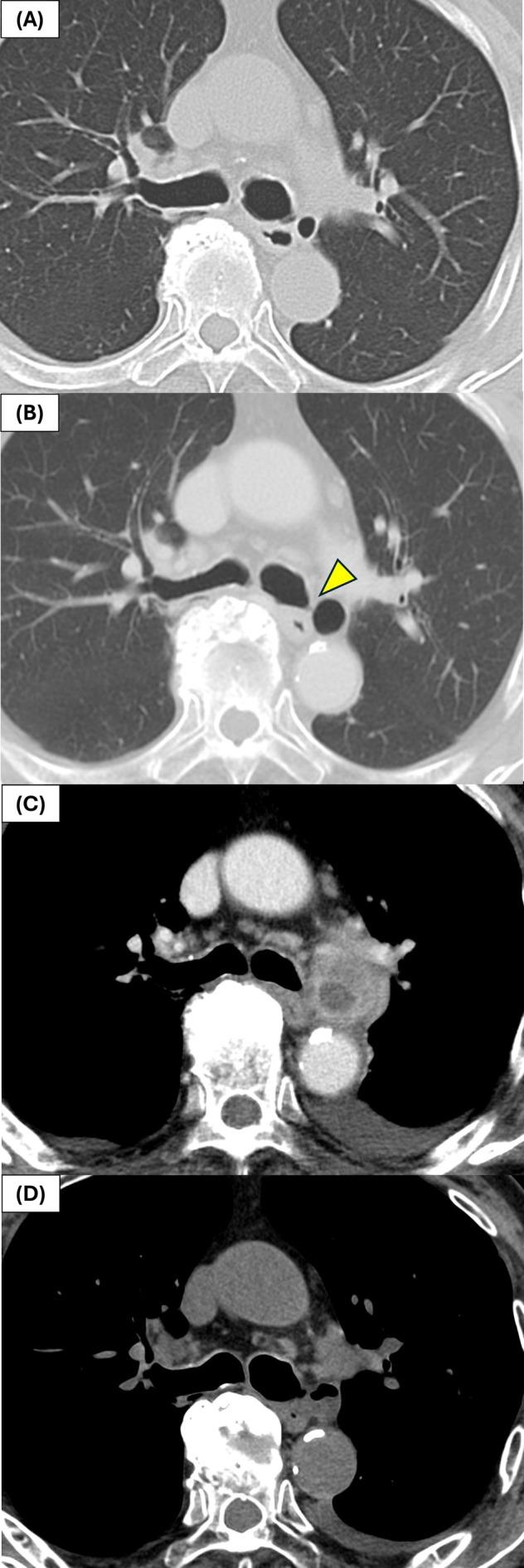 https://cdn.ncbi.nlm.nih.gov/pmc/blobs/57cc/12183338/eee95394e0b5/RCR2-13-e70251-g001.jpg