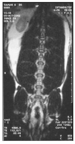 https://cdn.ncbi.nlm.nih.gov/pmc/blobs/57d0/5447923/0093381180c2/TOORTHJ-11-404_F7.jpg