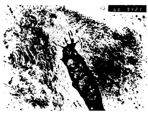 https://cdn.ncbi.nlm.nih.gov/pmc/blobs/57d0/5447923/9db93b6ac64d/TOORTHJ-11-404_F6.jpg