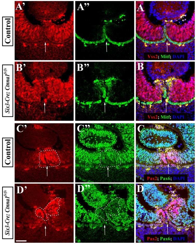 https://cdn.ncbi.nlm.nih.gov/pmc/blobs/57d3/3519883/292f573c11b2/pone.0051705.g004.jpg