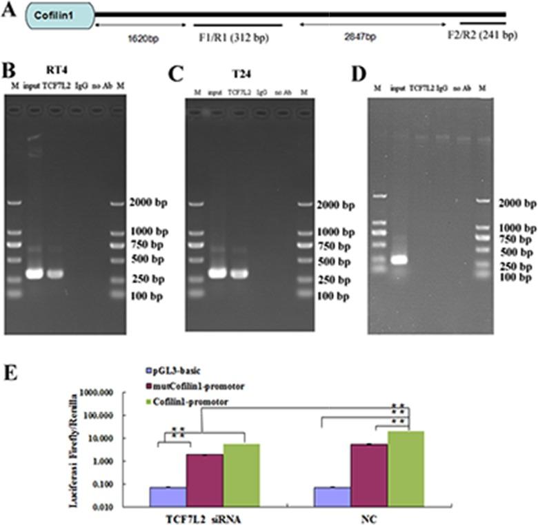 https://cdn.ncbi.nlm.nih.gov/pmc/blobs/57d5/5696162/a3a123d7fd39/oncotarget-08-92043-g004.jpg