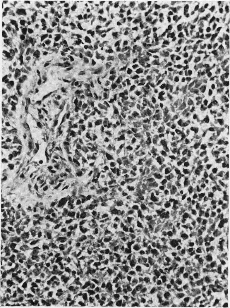 https://cdn.ncbi.nlm.nih.gov/pmc/blobs/57d6/2008903/054c344410eb/brjcancer00343-0047-b.jpg