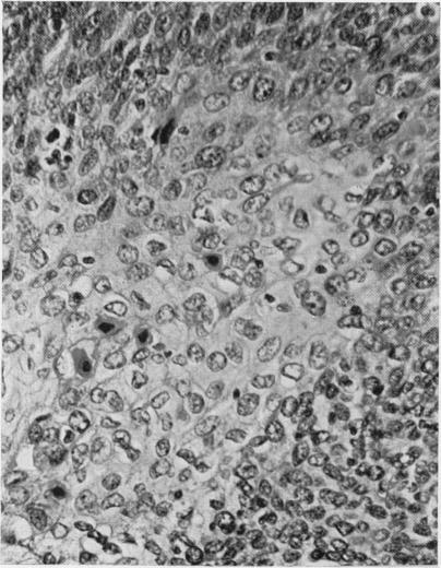 https://cdn.ncbi.nlm.nih.gov/pmc/blobs/57d6/2008903/f813f2151f12/brjcancer00343-0046-b.jpg