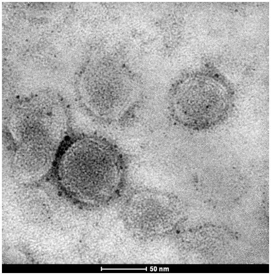 https://cdn.ncbi.nlm.nih.gov/pmc/blobs/57da/6126448/ff4095aca196/fcimb-08-00303-g0002.jpg