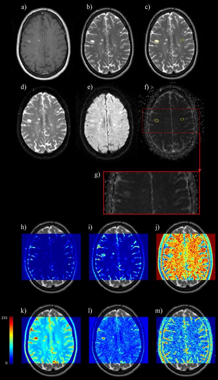 https://cdn.ncbi.nlm.nih.gov/pmc/blobs/57e0/4687842/d3f44456d25a/pone.0145497.g001.jpg