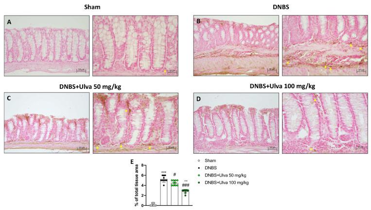https://cdn.ncbi.nlm.nih.gov/pmc/blobs/57e1/10223675/1c3d358899cd/marinedrugs-21-00298-g003.jpg