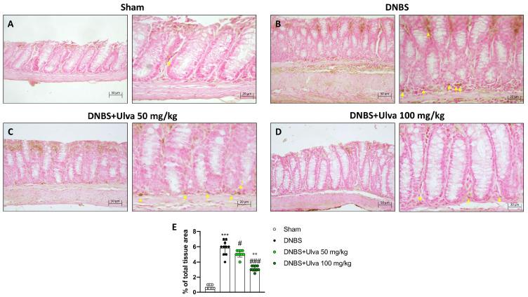 https://cdn.ncbi.nlm.nih.gov/pmc/blobs/57e1/10223675/5717a050c484/marinedrugs-21-00298-g004.jpg