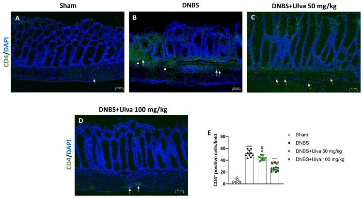 https://cdn.ncbi.nlm.nih.gov/pmc/blobs/57e1/10223675/724589ded1da/marinedrugs-21-00298-g007.jpg