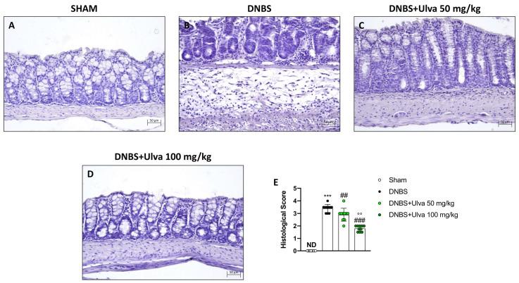 https://cdn.ncbi.nlm.nih.gov/pmc/blobs/57e1/10223675/7b012efa5254/marinedrugs-21-00298-g002.jpg