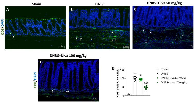 https://cdn.ncbi.nlm.nih.gov/pmc/blobs/57e1/10223675/98091c0967c5/marinedrugs-21-00298-g008.jpg