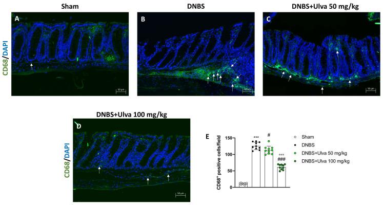 https://cdn.ncbi.nlm.nih.gov/pmc/blobs/57e1/10223675/f6cb37ed9601/marinedrugs-21-00298-g006.jpg
