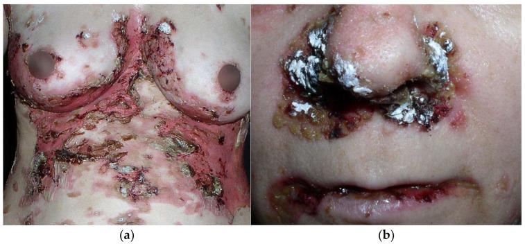 https://cdn.ncbi.nlm.nih.gov/pmc/blobs/57e1/11988160/30f625ae4369/cancers-17-01053-g004.jpg