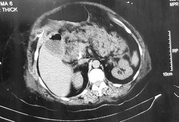 https://cdn.ncbi.nlm.nih.gov/pmc/blobs/57e5/5845204/59a651f20ce4/13104_2018_3274_Fig2_HTML.jpg