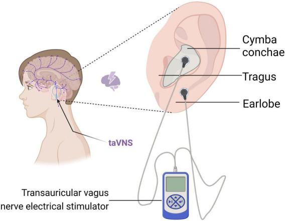 https://cdn.ncbi.nlm.nih.gov/pmc/blobs/57e6/11652481/a2770ecf7d3b/fnins-18-1494272-g003.jpg