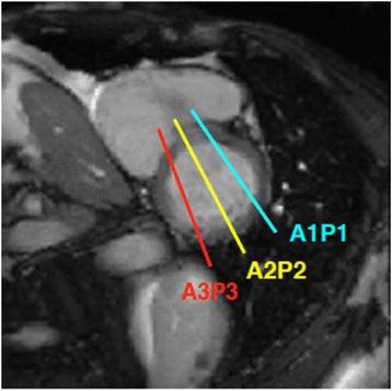 https://cdn.ncbi.nlm.nih.gov/pmc/blobs/57ea/5747097/2dd8878832a2/12880_2017_238_Fig12_HTML.jpg