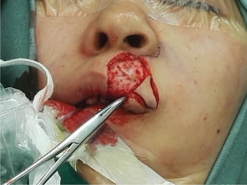 https://cdn.ncbi.nlm.nih.gov/pmc/blobs/57ea/5895308/63fcf108c249/medi-97-e0191-g002.jpg
