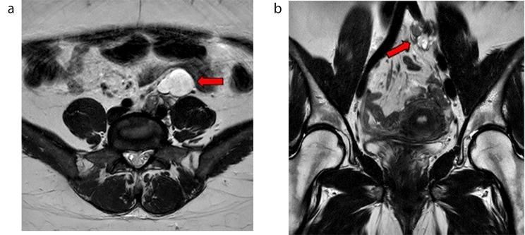 https://cdn.ncbi.nlm.nih.gov/pmc/blobs/57ed/11165822/caddd3ee2914/12902_2024_1606_Fig1_HTML.jpg