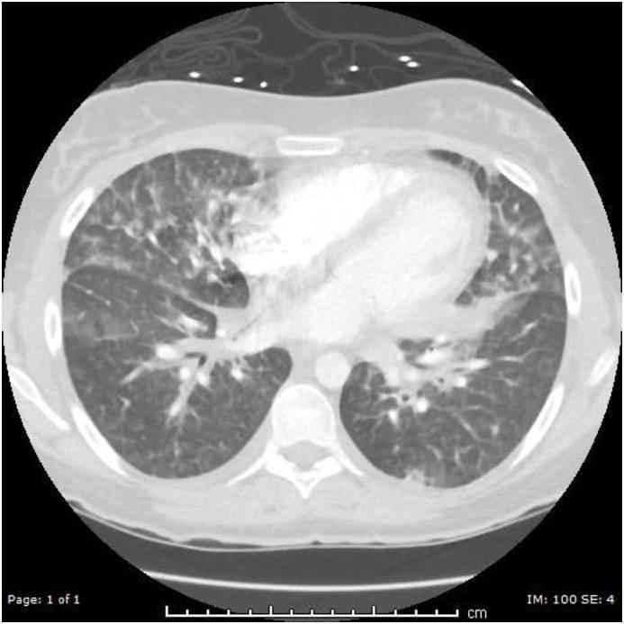 https://cdn.ncbi.nlm.nih.gov/pmc/blobs/57f0/6434163/4fbaa06a4be1/gr1.jpg