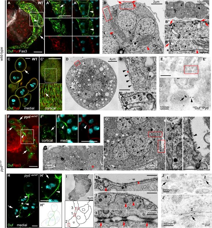 https://cdn.ncbi.nlm.nih.gov/pmc/blobs/57f3/6605796/4fa736fc502f/JCB_201810171_Fig1.jpg