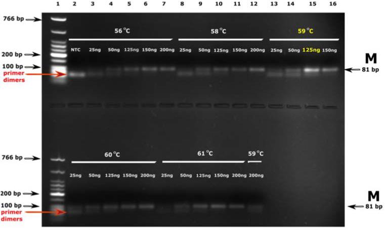 https://cdn.ncbi.nlm.nih.gov/pmc/blobs/57f5/9914267/f346f3b72bde/diagnostics-13-00360-g001.jpg