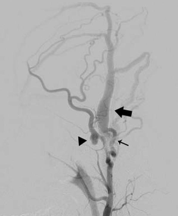 https://cdn.ncbi.nlm.nih.gov/pmc/blobs/57f6/4690004/2bf7e7ec76d6/rjv15602.jpg